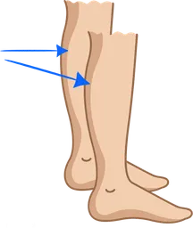 calves.webp